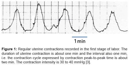 Pregnancy Contractions Chart