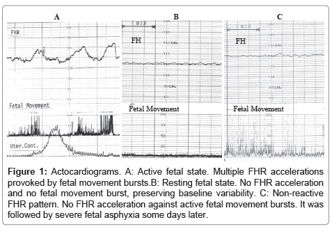 Fetal Movement Monitoring Chart