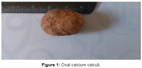 homeopathy-ayurvedic-Oval-calciumcalculi