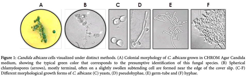 Candida igg