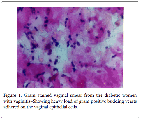 infectious-diseases-therapy-Gram-stained