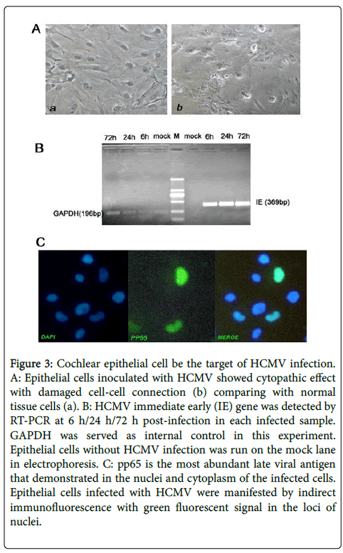 infectious-diseases-therapy-HCMV-infection