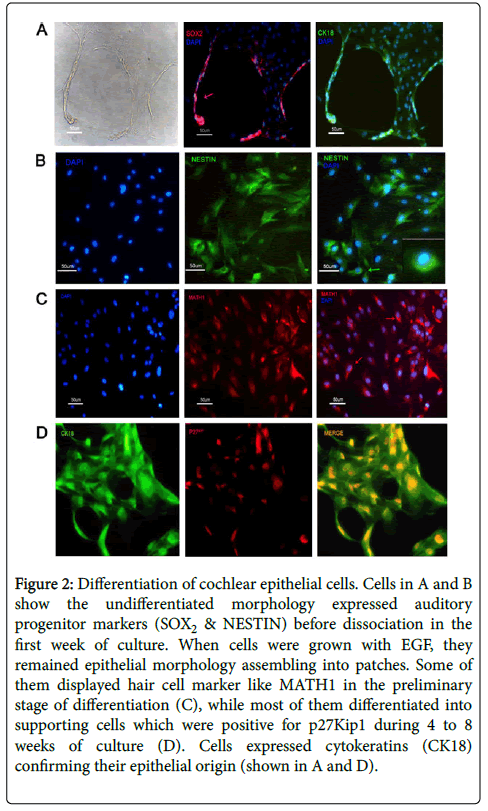 infectious-diseases-therapy-cochlear-epithelial