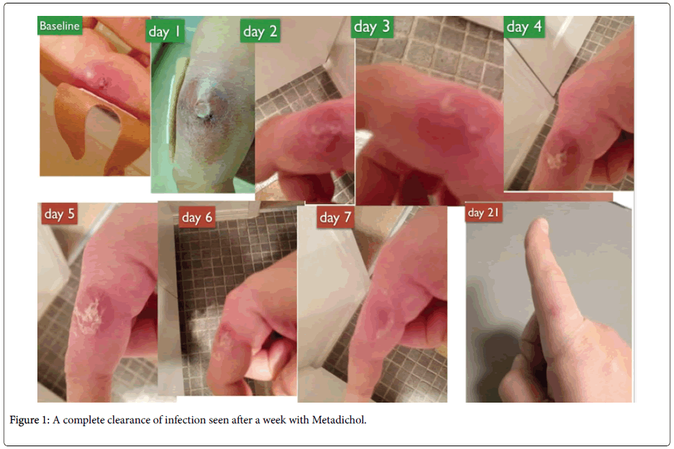 infectious-diseases-therapy-complete-clearance