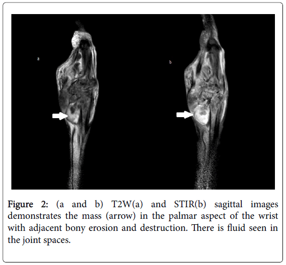 infectious-diseases-therapy-joint-spaces