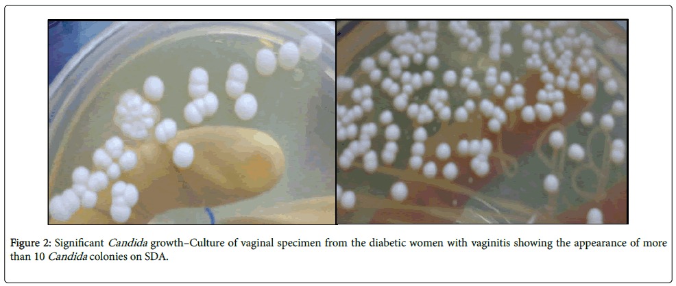 infectious-diseases-therapy-vaginal-specimen