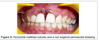 interdisciplinary-eugenol-periodontal