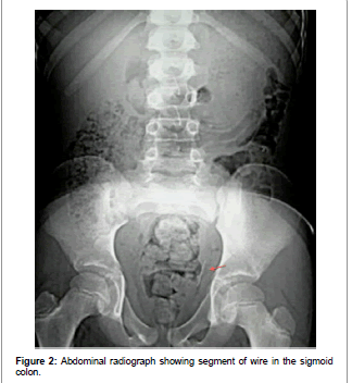 interdisciplinary-medicine-Abdominal-radiograph