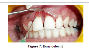 interdisciplinary-medicine-Bony