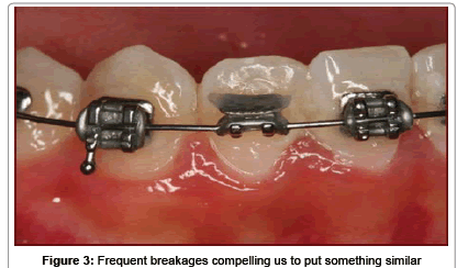 interdisciplinary-medicine-Frequent-breakages-compelling