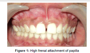 interdisciplinary-medicine-High-frenal