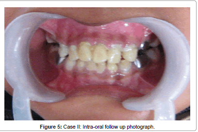 interdisciplinary-medicine-Intra-oral-follow