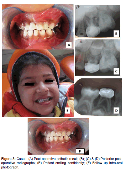 interdisciplinary-medicine-Patient-smiling-confidently