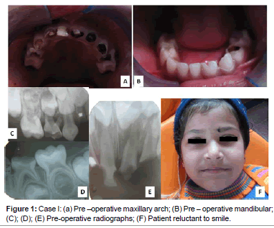 interdisciplinary-medicine-Pre-operative-maxillary