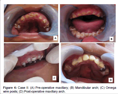 interdisciplinary-medicine-Pre-operative-maxillary