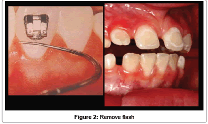 interdisciplinary-medicine-Remove-flash