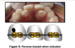 interdisciplinary-medicine-Reverse-bracket-indicated
