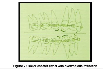 interdisciplinary-medicine-Roller-coaster-effect