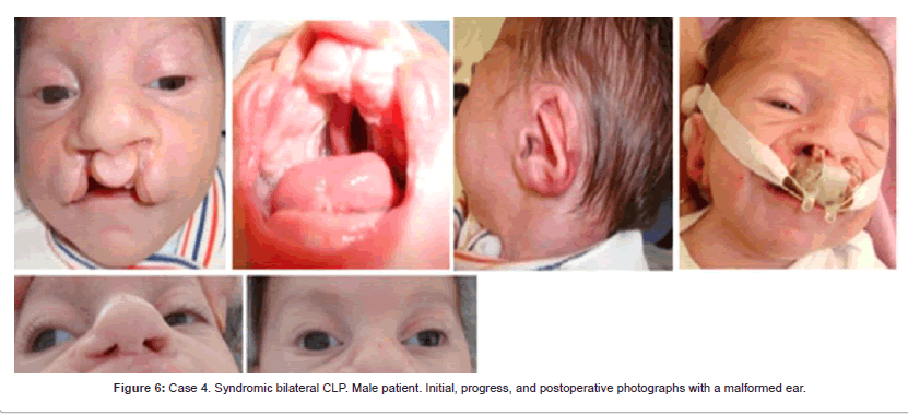 interdisciplinary-medicine-Syndromic-bilateral