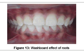 interdisciplinary-medicine-Washboard-effect-roots