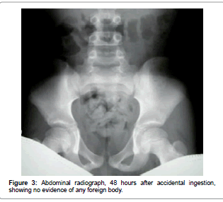 interdisciplinary-medicine-accidental-ingestion