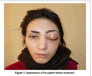 interdisciplinary-medicine-before-treatment