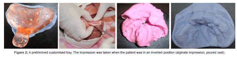 interdisciplinary-medicine-customised-impression