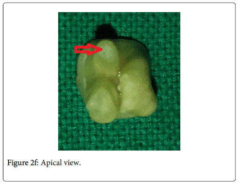 interdisciplinary-medicine-dental-science-Apical-view