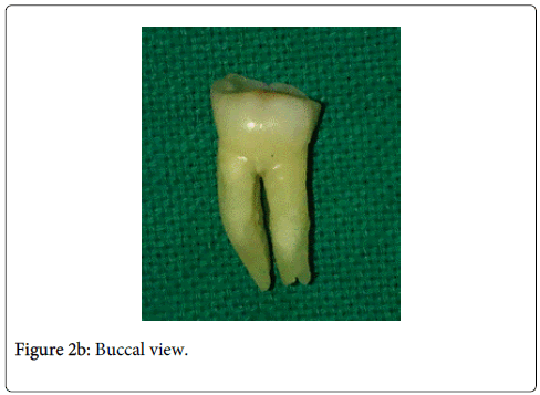 interdisciplinary-medicine-dental-science-Buccal-view
