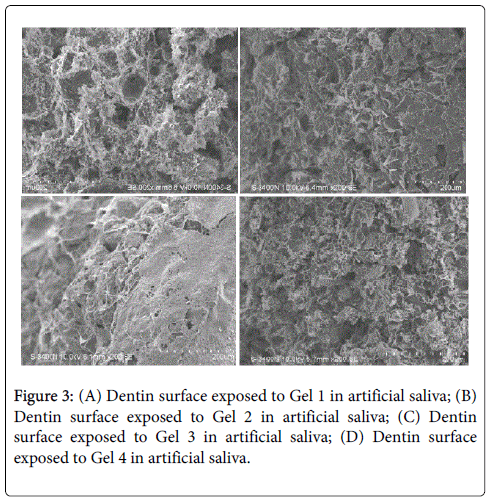 interdisciplinary-medicine-dental-science-Dentin-surface-exposed