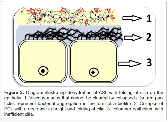 interdisciplinary-medicine-dental-science-Diagram-illustrating-dehydration-ASL