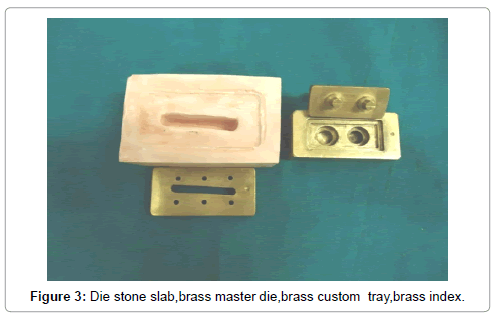 interdisciplinary-medicine-dental-science-Die-stone-slab