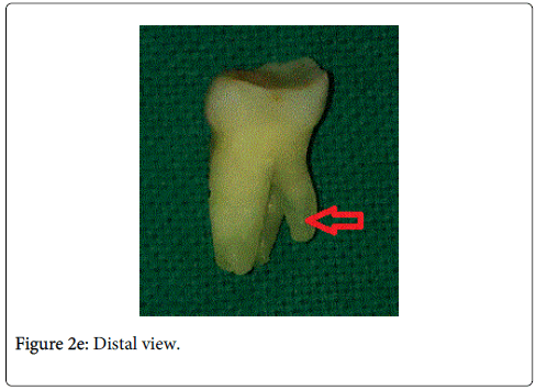 interdisciplinary-medicine-dental-science-Distal-view