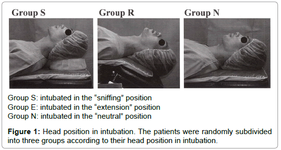interdisciplinary-medicine-dental-science-Head-position-intubation