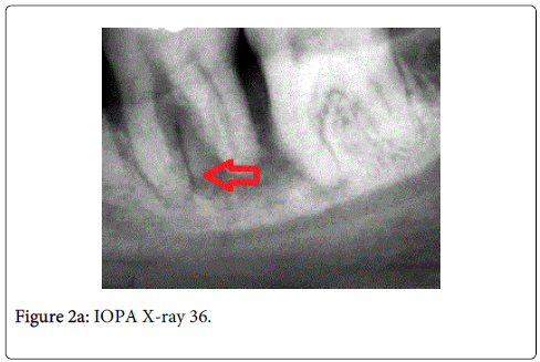 interdisciplinary-medicine-dental-science-IOPA-x-ray