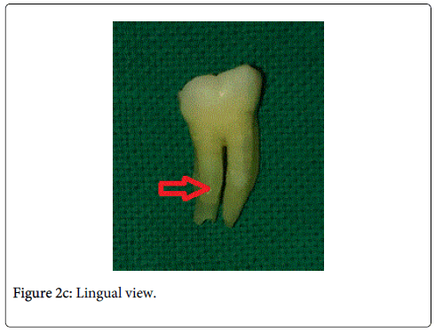 interdisciplinary-medicine-dental-science-Lingual-view