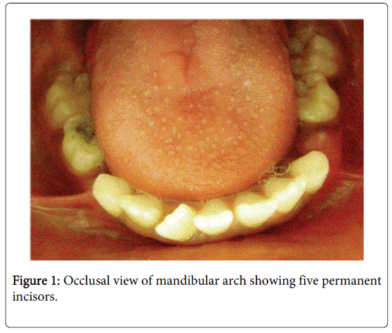 interdisciplinary-medicine-dental-science-Occlusal-view-mandibular