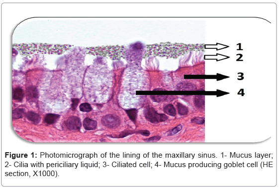 interdisciplinary-medicine-dental-science-Photomicrograph-maxillary-sinus-periciliary