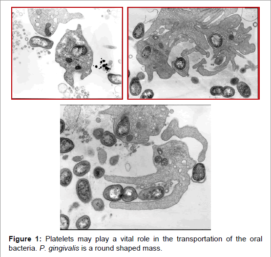 interdisciplinary-medicine-dental-science-Platelets-transportation-oral-bacteria
