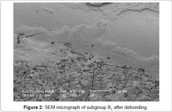 interdisciplinary-medicine-dental-science-SEM-micrograph-subgroup-B1