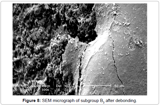 interdisciplinary-medicine-dental-science-SEM-micrograph-subgroup-B3