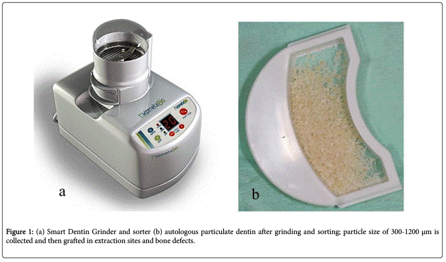 interdisciplinary-medicine-dental-science-Smart-Dentin-Grinder