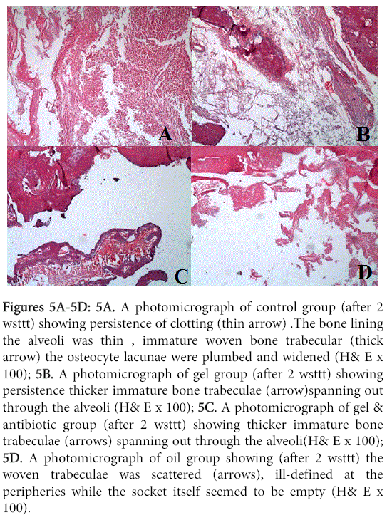 interdisciplinary-medicine-dental-science-bone-lining-alveoli