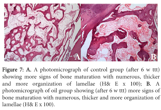 interdisciplinary-medicine-dental-science-bone-maturation-with-numerous