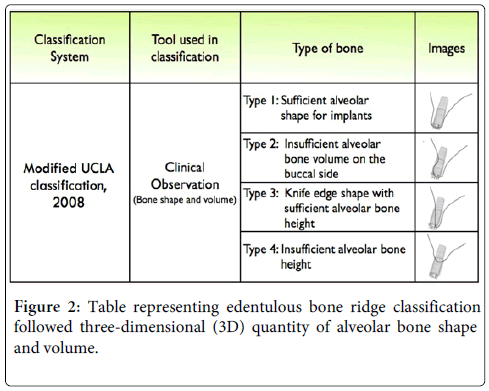 interdisciplinary-medicine-dental-science-bone-ridge-classification