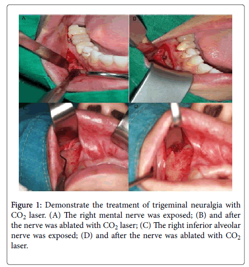 interdisciplinary-medicine-dental-science-denture