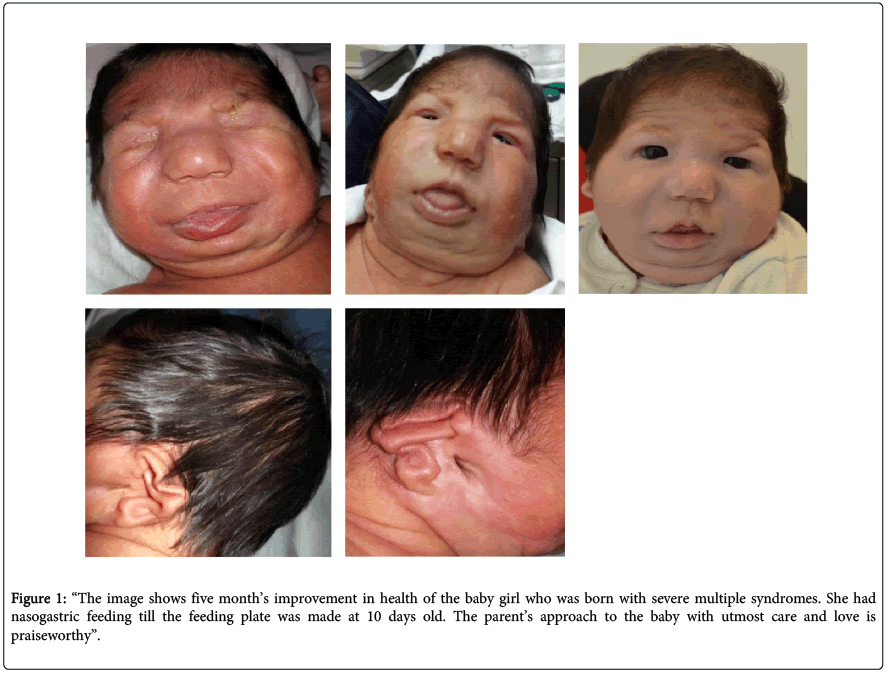 interdisciplinary-medicine-dental-science-image-shows-five-monthâ??s