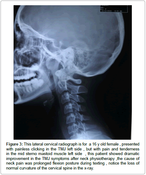 interdisciplinary-medicine-dental-science-lateral-cervical-radiograph