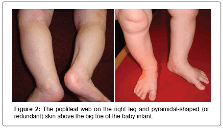 interdisciplinary-medicine-dental-science-leg-pyramidal-shaped