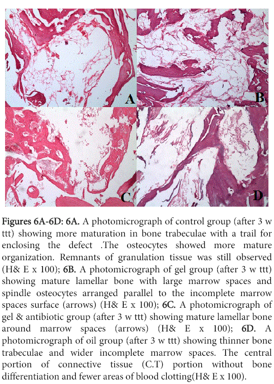 interdisciplinary-medicine-dental-science-osteocytes-showed-more-mature